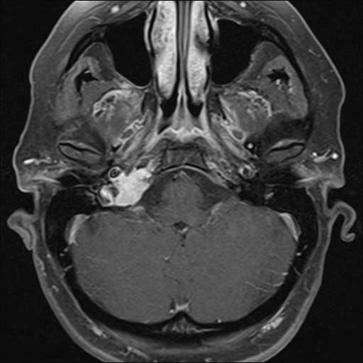 Scan of head and neck